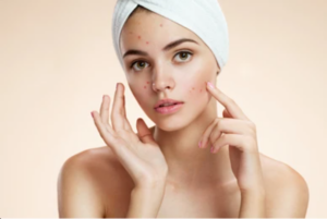 Effective-Strategies-to-Safeguard-Skin-Health-Preventing-Skin-Diseases